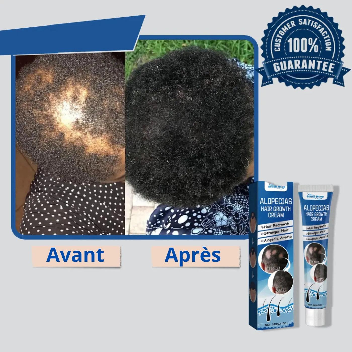 Alopécie Créme BN